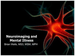 Neuroimaging and Mental Illness Brian Wells, MS3, MSM, MPH 