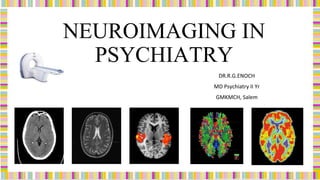 NEUROIMAGING IN
PSYCHIATRY
DR.R.G.ENOCH
MD Psychiatry II Yr
GMKMCH, Salem
 
