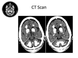 Neuroimaging basics | PPTX