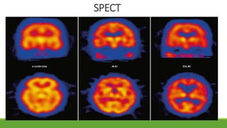 Neuroimaging in dementia | PPTX