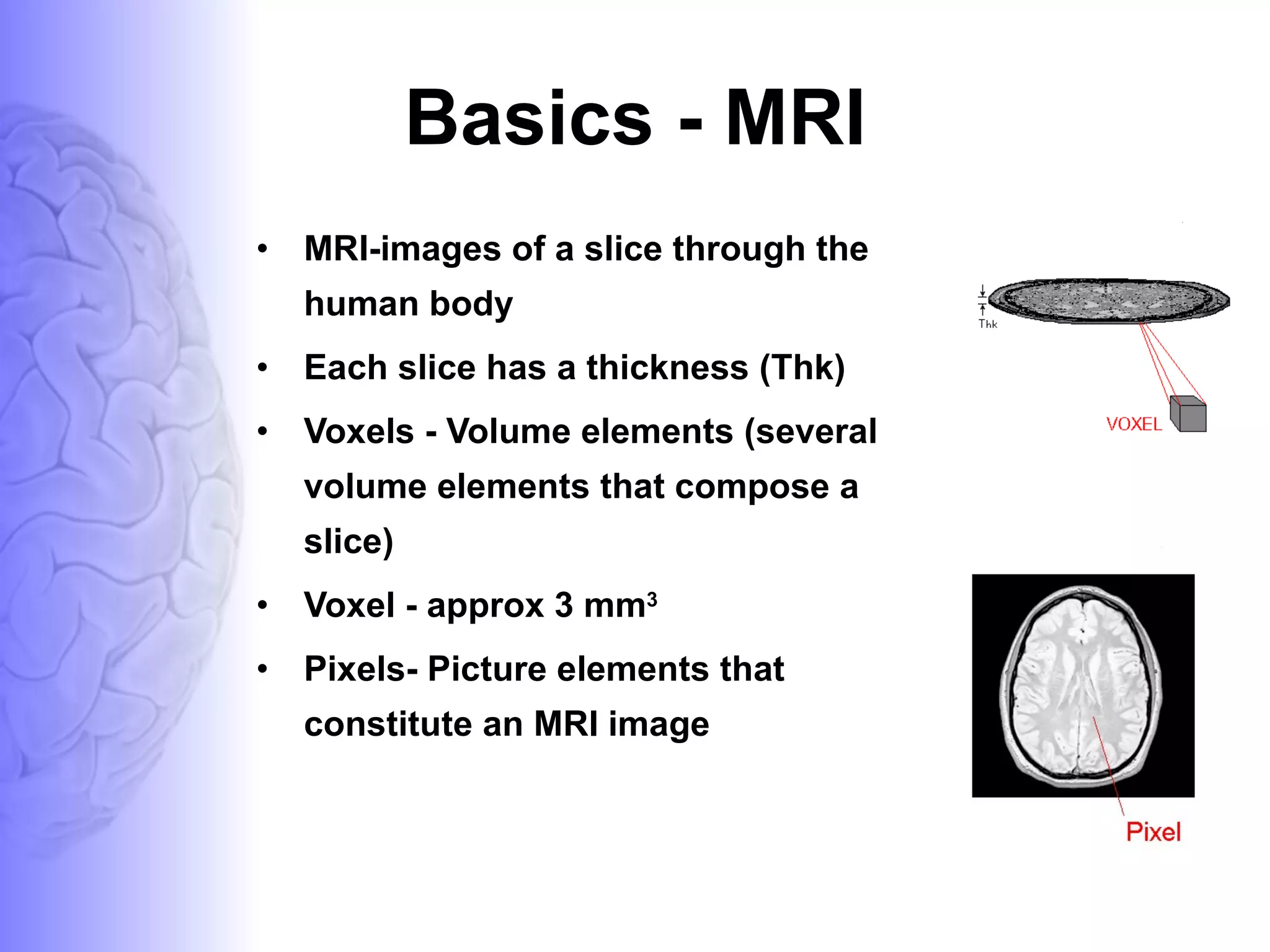 Basics - MRI MRI-images of a slice through the human body Each slice has a thickness (Thk) Voxels - Volume elements (several volume elements that compose a slice)  Voxel - approx 3 mm 3 Pixels- Picture elements that constitute an MRI image  