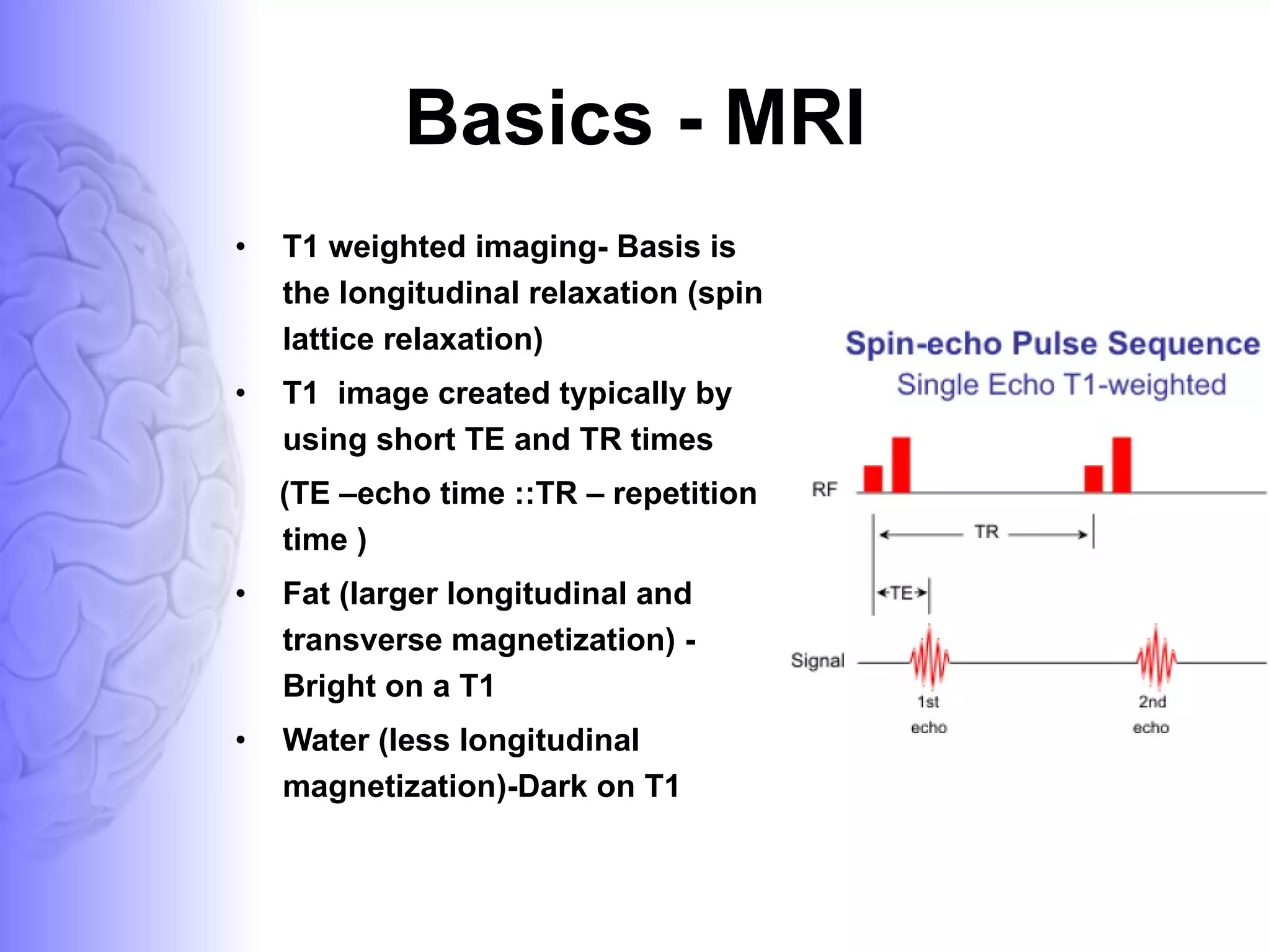 Basics - MRI T1 weighted imaging- Basis is the longitudinal relaxation (spin lattice relaxation) T1  image created typically by using short TE and TR times (TE –echo time ::TR – repetition time ) Fat (larger longitudinal and transverse magnetization) - Bright on a T1  Water (less longitudinal magnetization)-Dark on T1 