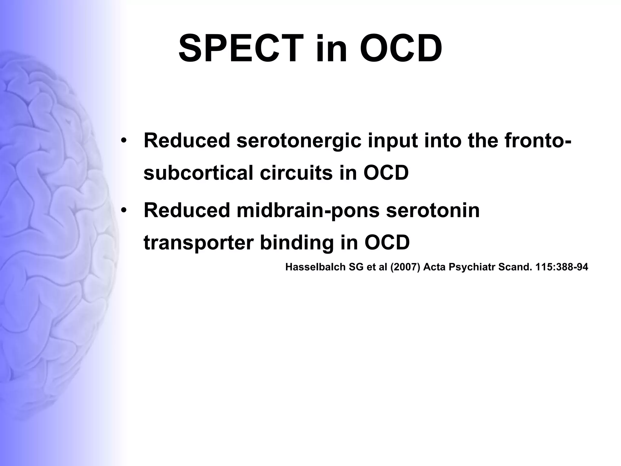 SPECT in OCD Reduced serotonergic input into the fronto-subcortical circuits in OCD  Reduced midbrain-pons serotonin transporter binding in OCD Hasselbalch SG et al (2007) Acta Psychiatr Scand. 115:388-94  