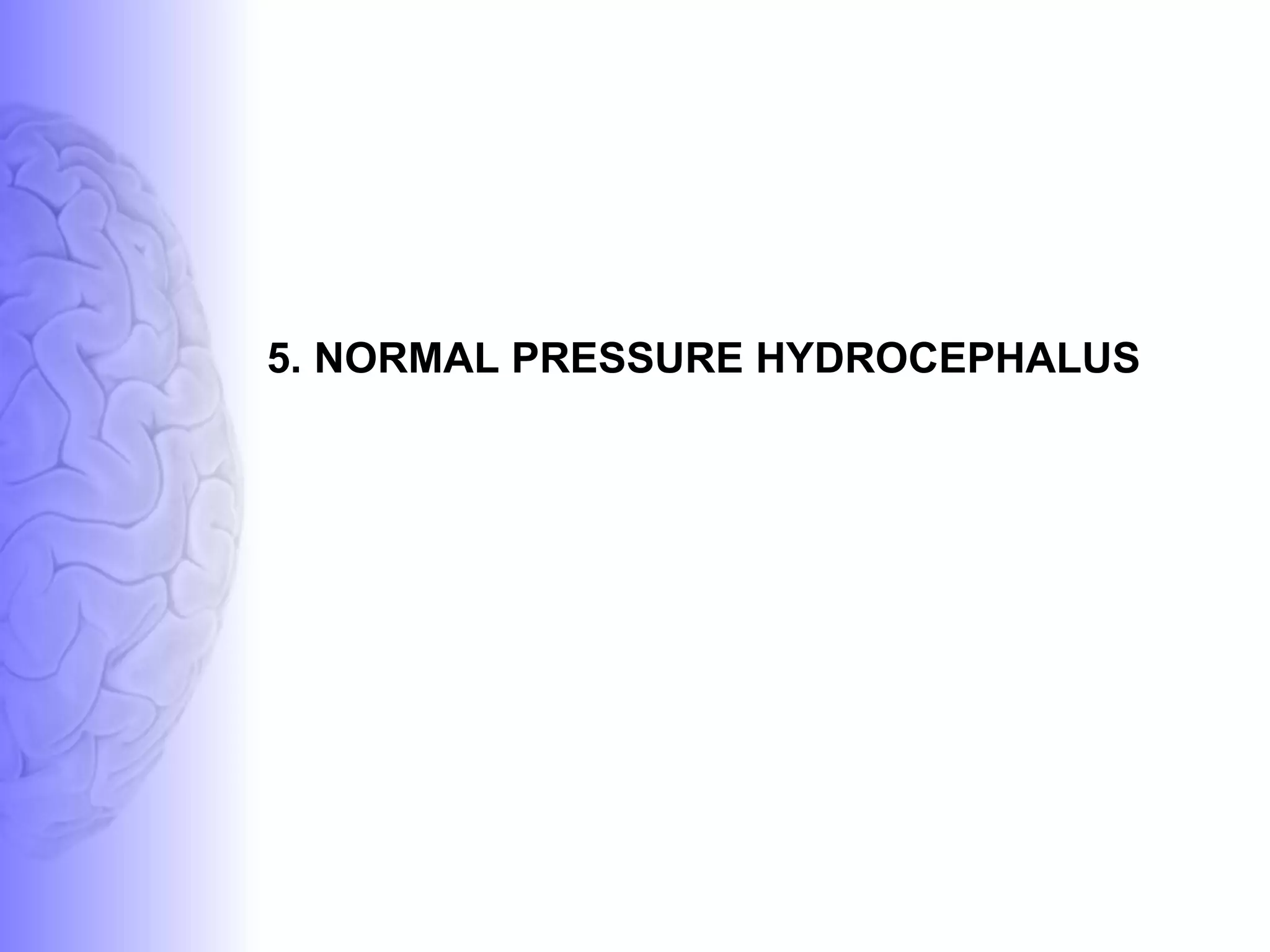 5. NORMAL PRESSURE HYDROCEPHALUS 