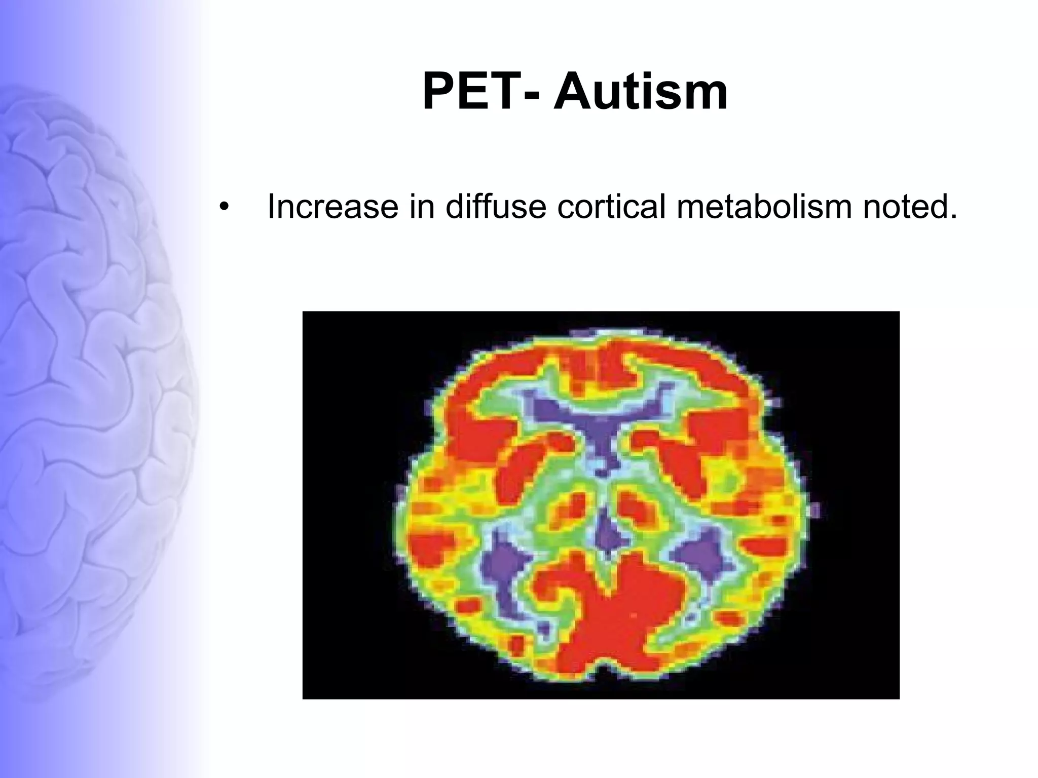 PET- Autism Increase in diffuse cortical metabolism noted. 