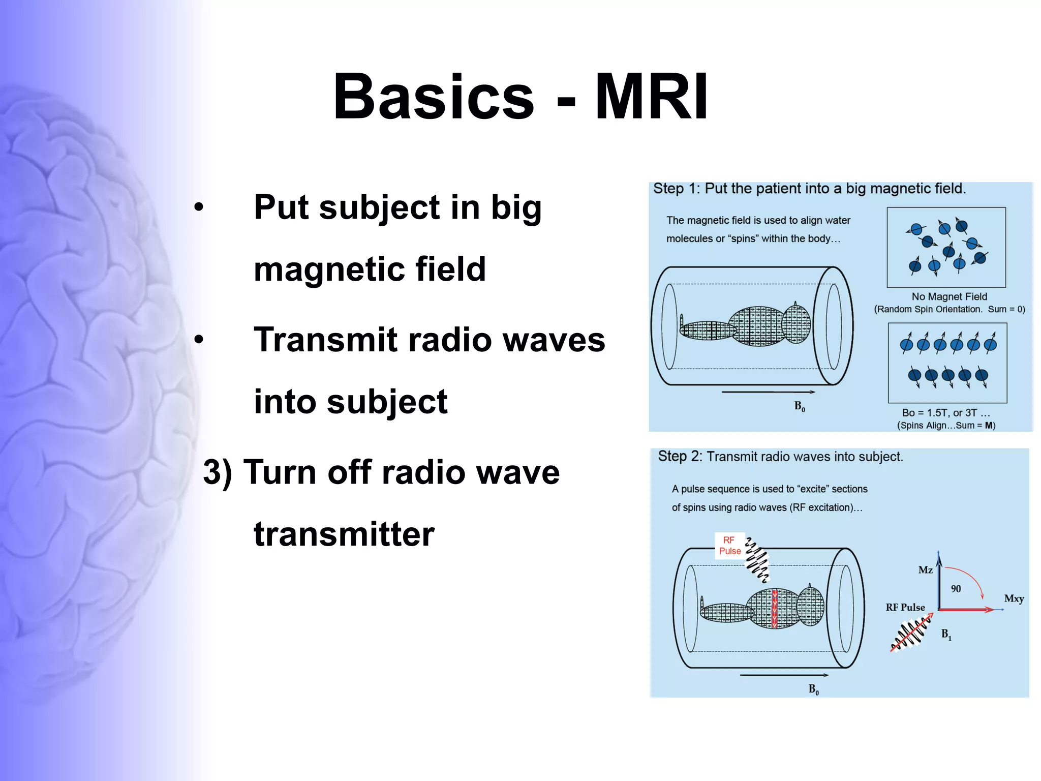 Basics - MRI Put subject in big magnetic field  Transmit radio waves into subject  [about 3  3) Turn off radio wave transmitter 