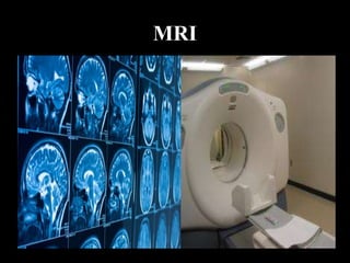 MRI
 