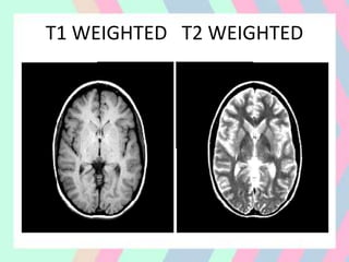 T1 WEIGHTED T2 WEIGHTED
 