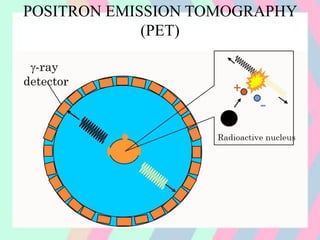 POSITRON EMISSION TOMOGRAPHY
(PET)
 