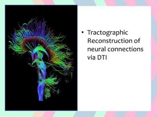 • Tractographic
Reconstruction of
neural connections
via DTI
 