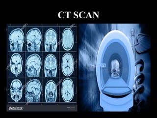 CT SCAN
 