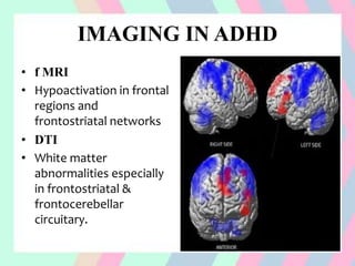 IMAGING IN ADHD
• f MRI
• Hypoactivation in frontal
regions and
frontostriatal networks
• DTI
• White matter
abnormalities especially
in frontostriatal &
frontocerebellar
circuitary.
 