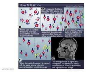 MODALITIES © 2008 HowStuffWorks.com
 