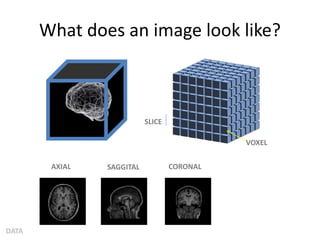 What does an image look like?
DATA
SLICE
VOXEL
AXIAL SAGGITAL CORONAL
 