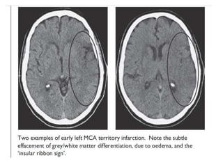 Neuroimaging by dr k k sharma
