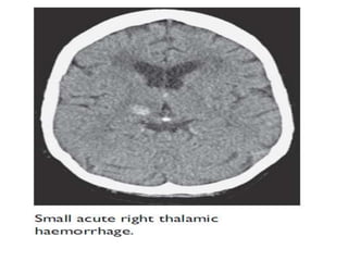 Neuroimaging by dr k k sharma