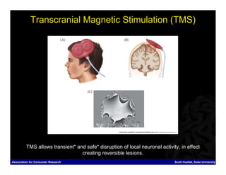 Transcranial Magnetic Stimulation (TMS)




         TMS allows transient* and safe* disruption of local neuronal activity, in effect
                                 creating reversible lesions.
Association for Consumer Research                                            Scott Huettel, Duke University
 