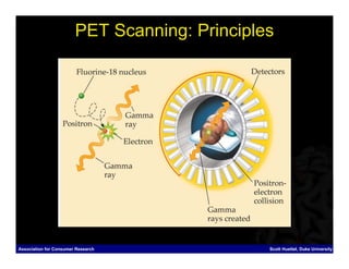 PET Scanning: Principles




Association for Consumer Research              Scott Huettel, Duke University
 