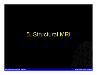 5. Structural MRI




Association for Consumer Research                       Scott Huettel, Duke University
 