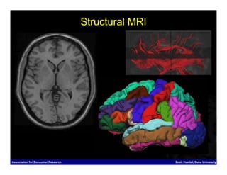 Structural MRI




Association for Consumer Research                    Scott Huettel, Duke University
 