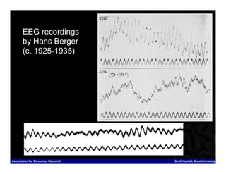 EEG recordings
       by Hans Berger
       (c. 1925-1935)




Association for Consumer Research   Scott Huettel, Duke University
 