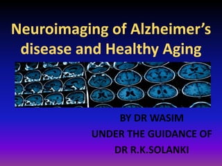 Neuroimaging of Alzheimer’s
disease and Healthy Aging
BY DR WASIM
UNDER THE GUIDANCE OF
DR R.K.SOLANKI
 