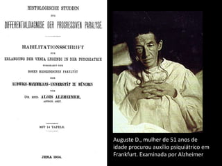 Deformidade no nervo ulnar (sequela)Neurite do nervo ulnar