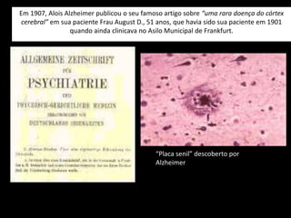 Tratamento da infecçãoPAUCIBACILARMULTIBACILARDapsonaRifampicinaClofazimina