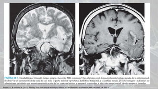 Ropper, A., & Samuels, M. (2011). Adams y Victor Principios de neurología. México, DF: McGRAW-HILL INTERAMERICANA EDITORES, S.A. de C.V.
 