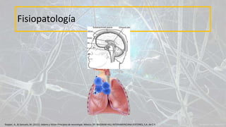 Fisiopatología
Ropper, A., & Samuels, M. (2011). Adams y Victor Principios de neurología. México, DF: McGRAW-HILL INTERAMERICANA EDITORES, S.A. de C.V.
 