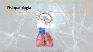 Fisiopatología
Ropper, A., & Samuels, M. (2011). Adams y Victor Principios de neurología. México, DF: McGRAW-HILL INTERAMERICANA EDITORES, S.A. de C.V.
 