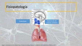 Fisiopatología
Endocitosis Destrucción de
uniones celulares
Ropper, A., & Samuels, M. (2011). Adams y Victor Principios de neurología. México, DF: McGRAW-HILL INTERAMERICANA EDITORES, S.A. de C.V.
 