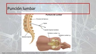 Punción lumbar
Ropper, A., & Samuels, M. (2011). Adams y Victor Principios de neurología. México, DF: McGRAW-HILL INTERAMERICANA EDITORES, S.A. de C.V.
 