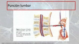 Punción lumbar
Ropper, A., & Samuels, M. (2011). Adams y Victor Principios de neurología. México, DF: McGRAW-HILL INTERAMERICANA EDITORES, S.A. de C.V.
 