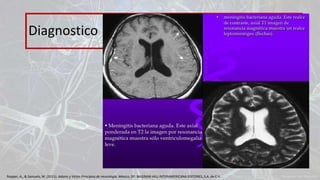 Diagnostico
Ropper, A., & Samuels, M. (2011). Adams y Victor Principios de neurología. México, DF: McGRAW-HILL INTERAMERICANA EDITORES, S.A. de C.V.
 