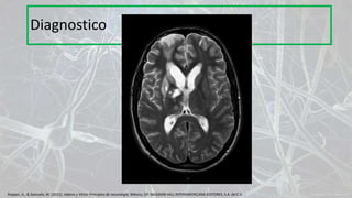 Diagnostico
Ropper, A., & Samuels, M. (2011). Adams y Victor Principios de neurología. México, DF: McGRAW-HILL INTERAMERICANA EDITORES, S.A. de C.V.
 