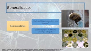 Generalidades
Son secundarias
¿Hay infección pulmonar, piel u otros
órganos?
Cuadro encefálico multifocal o
meníngeo subagudo
Ropper, A., & Samuels, M. (2011). Adams y Victor Principios de neurología. México, DF: McGRAW-HILL INTERAMERICANA EDITORES, S.A. de C.V.
Bonifaz Trujillo, A. J. (2012). Micología médica básica. Ciudad de México, México: McGRAW-HILL INTERAMERICANA EDITORES, S.A. de C.V.
 
