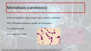 Monialiasis (candidosis)
Infección primaria: orina, sangre, piel, corazón y pulmones
50%  Examen directo se puede ver la levadura
Tx: Anfotericina B
Pronostico muy malo
Ropper, A., & Samuels, M. (2011). Adams y Victor Principios de neurología. México, DF: McGRAW-HILL INTERAMERICANA EDITORES, S.A. de C.V.
Bonifaz Trujillo, A. J. (2012). Micología médica básica. Ciudad de México, México: McGRAW-HILL INTERAMERICANA EDITORES, S.A. de C.V.
 