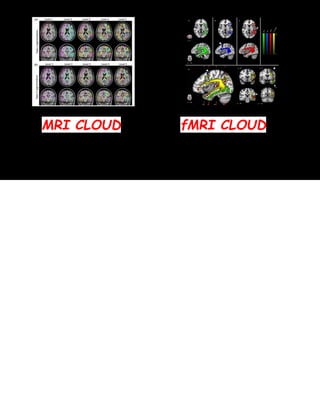 MRI CLOUD fMRI CLOUD
 