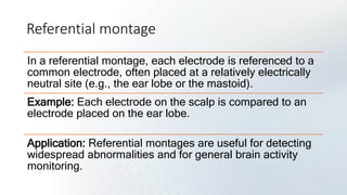 Neuroinstrumentation in clinical neurology (EEG&NCS).pptx
