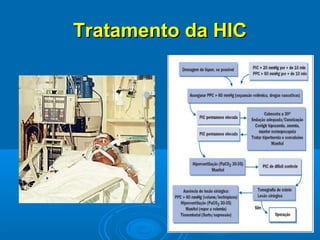Tratamento da HIC
 