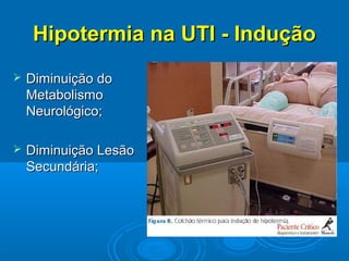 Hipotermia na UTI - Indução
   Diminuição do
    Metabolismo
    Neurológico;

   Diminuição Lesão
    Secundária;
 