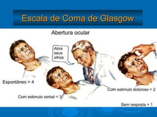 Escala de Coma de Glasgow
 