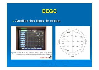 EEGC
Análise dos tipos de ondas
 