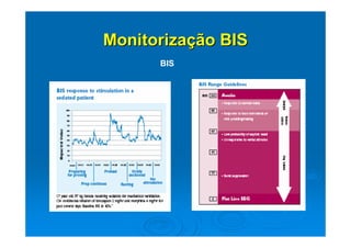 Monitorização BIS
      BIS
 