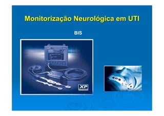 Monitorização Neurológica em UTI
             BIS
 