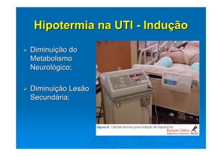 Hipotermia na UTI - Indução

Diminuição do
Metabolismo
Neurológico;

Diminuição Lesão
Secundária;
 