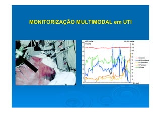 MONITORIZAÇÃO MULTIMODAL em UTI
 