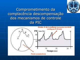 Ondas A de Lundberg   (aumentos de 40-80 mmHg por 5-10 min) Perda complacência Comprometimento da complacência descompensação dos mecanismos de controle da PIC 