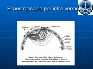 Espectroscopia por infra-vermelho 